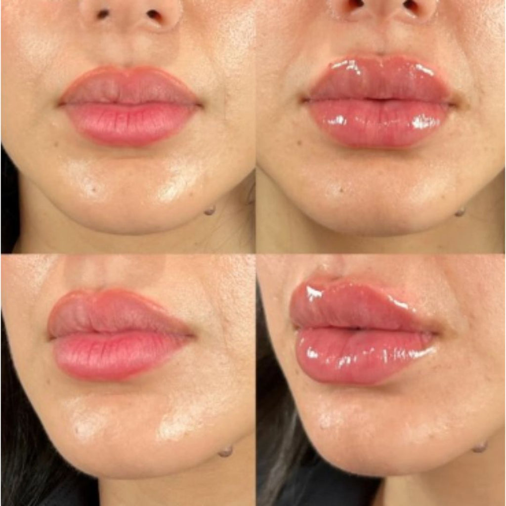 Julius Lip Plumper: Volum si luciu pentru buzele tale