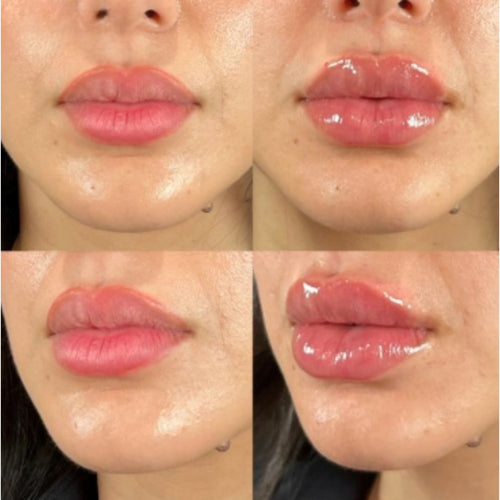 Julius Lip Plumper: Volum si luciu pentru buzele tale