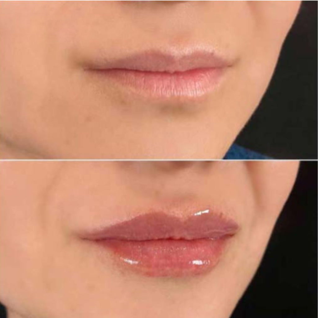 Julius Lip Plumper: Volum si luciu pentru buzele tale