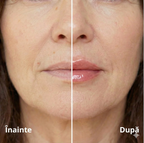 Creion Lip Plumper: Volum pentru buze