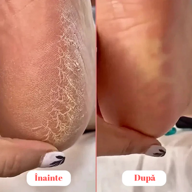 Pilă electrică profesională pentru picioare