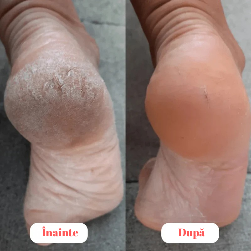 Pilă electrică profesională pentru picioare